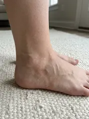 Sample photo: Ankle
