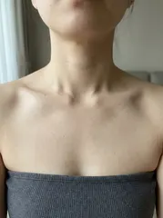 Sample photo: Collarbone
