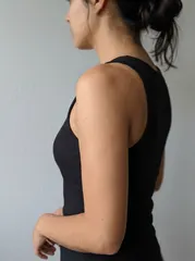 Sample photo: Upper arm