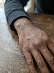 Sample photo: Wrist